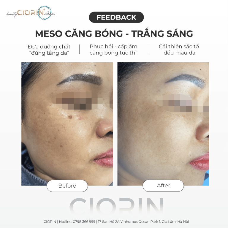 feedback khách hàng