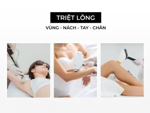 triệt lông tại CIORIN